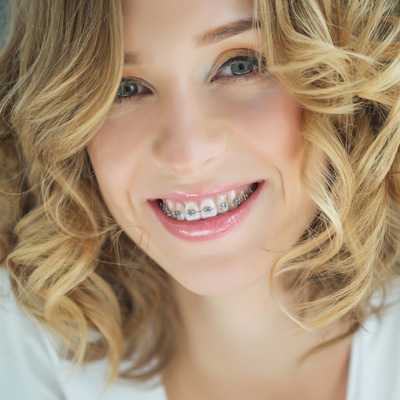 Ballard Dentistry | Invisalign reg , Teeth Whitening and Dental Fillings